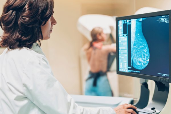 Google lupta pentru combaterea cancerului la san. Iata noua inventie a americanilor! mammography AI